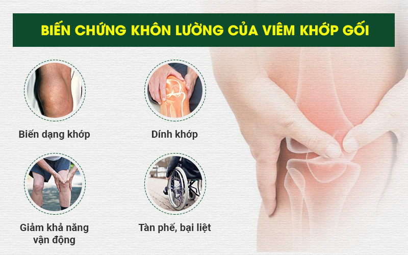 Viêm Khớp Gối: Nguyên nhân, triệu chứng & cách điều trị, giảm đau